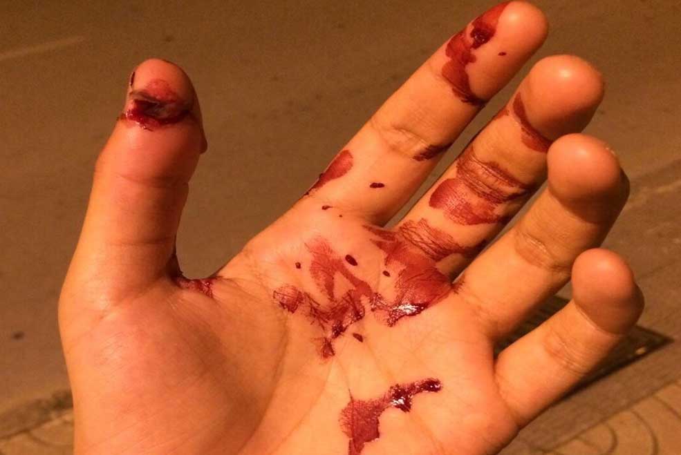 La policía ya ha identificado al presunto autor de la agresión homófoba a dos jóvenes en Torrelavega Agresionhomofoba