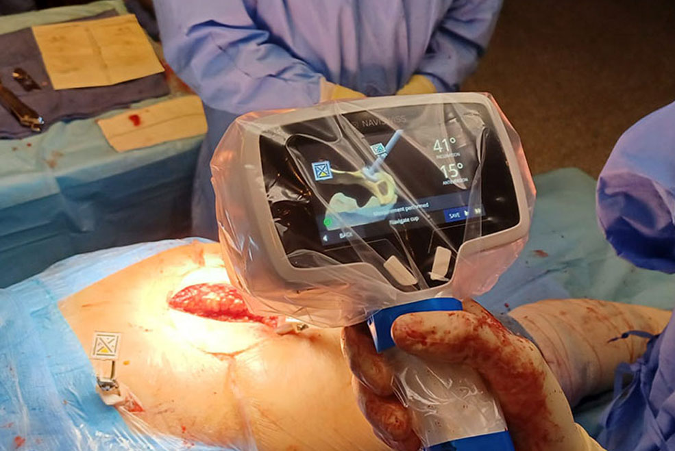 SierrallanaOperacionCadera